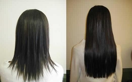 Фото до и после использования димексида для роста волос