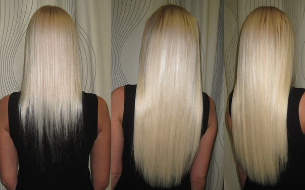 использования димексида для роста волос Фото до и после