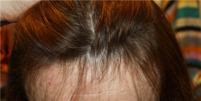 Отзывы после до и после фото применения мумиё для волос